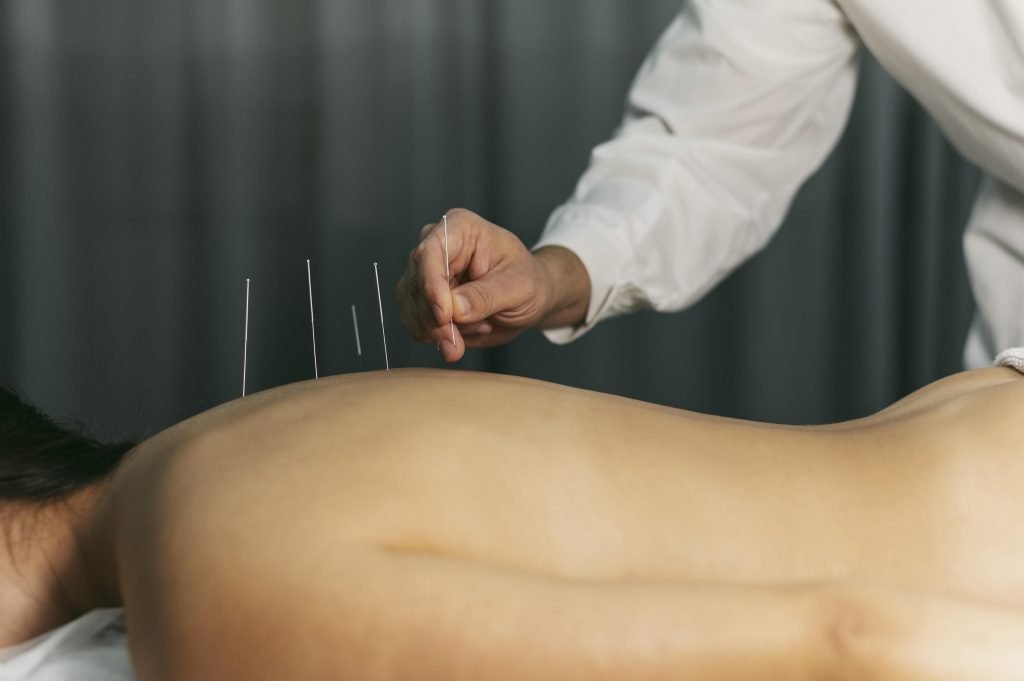 Acupuncturist in Westland