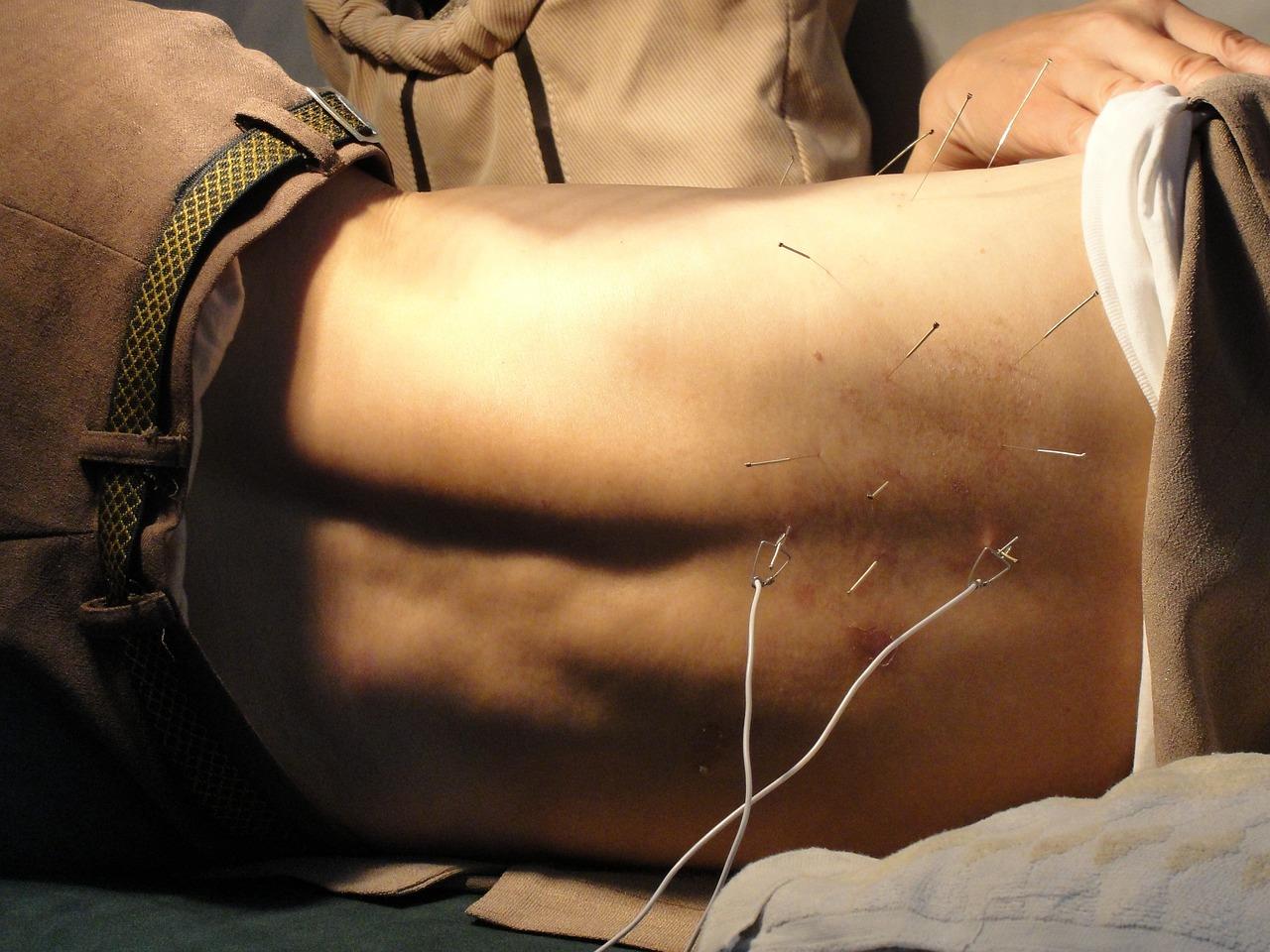 Acupuncturist in Westland