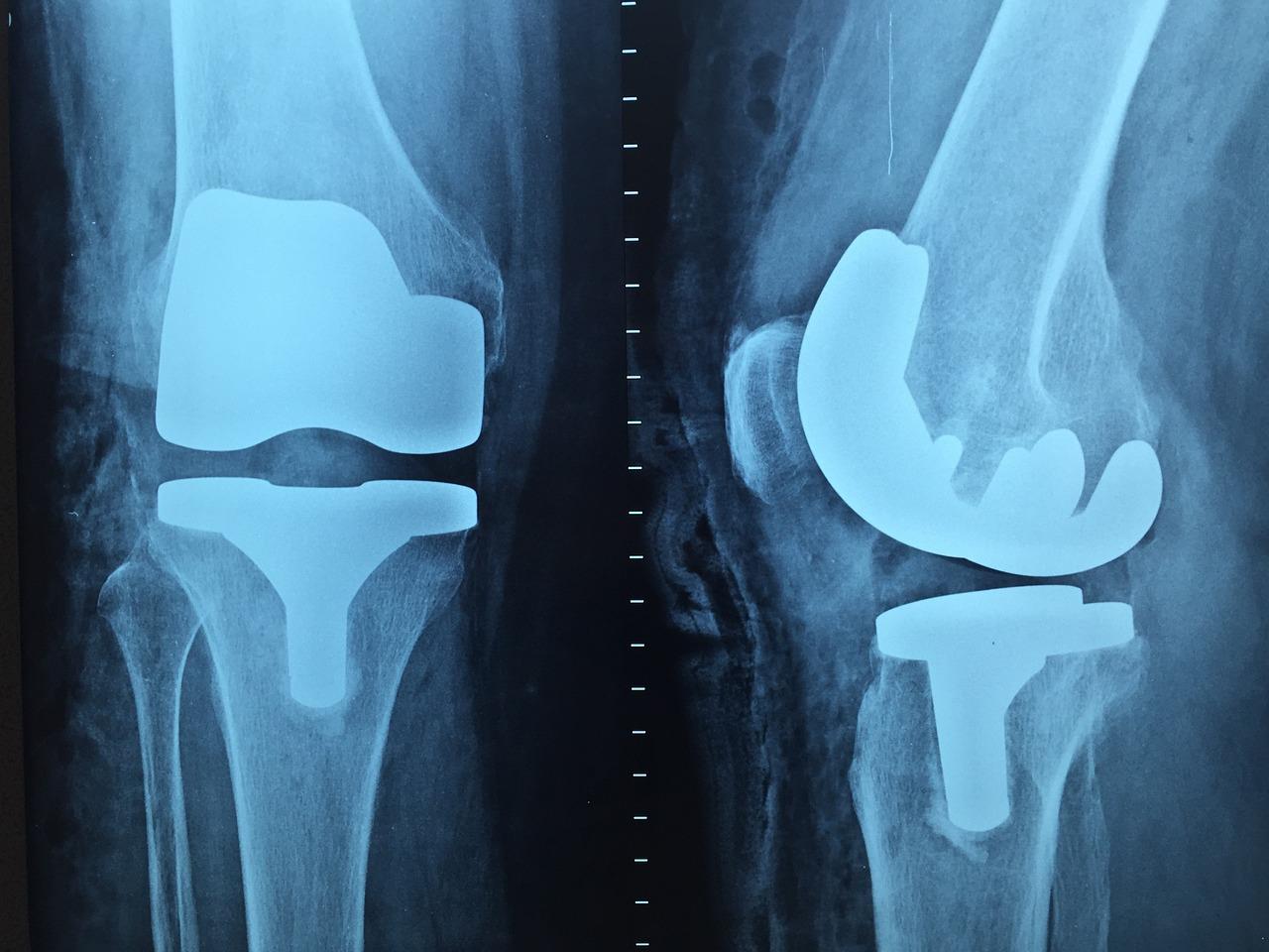 Orthopedie in Westland